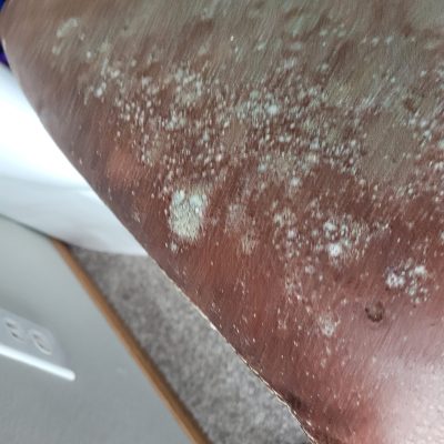 lose-up of mold spots on a leather chair, showcasing the damage that mold remediation services can address effectively.